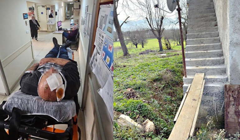 Merdivenlerden düşerek yaralandı