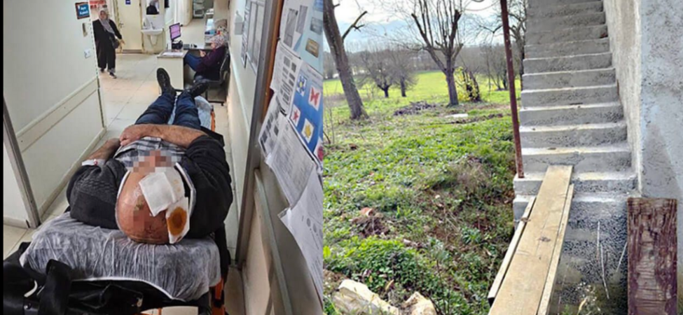 Merdivenlerden düşerek yaralandı